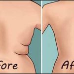 How-To-Get-Rid-Of-Back-Fat-At-Home