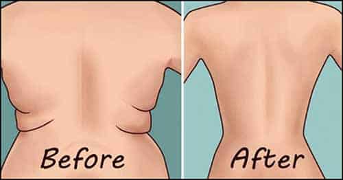 How-To-Get-Rid-Of-Back-Fat-At-Home